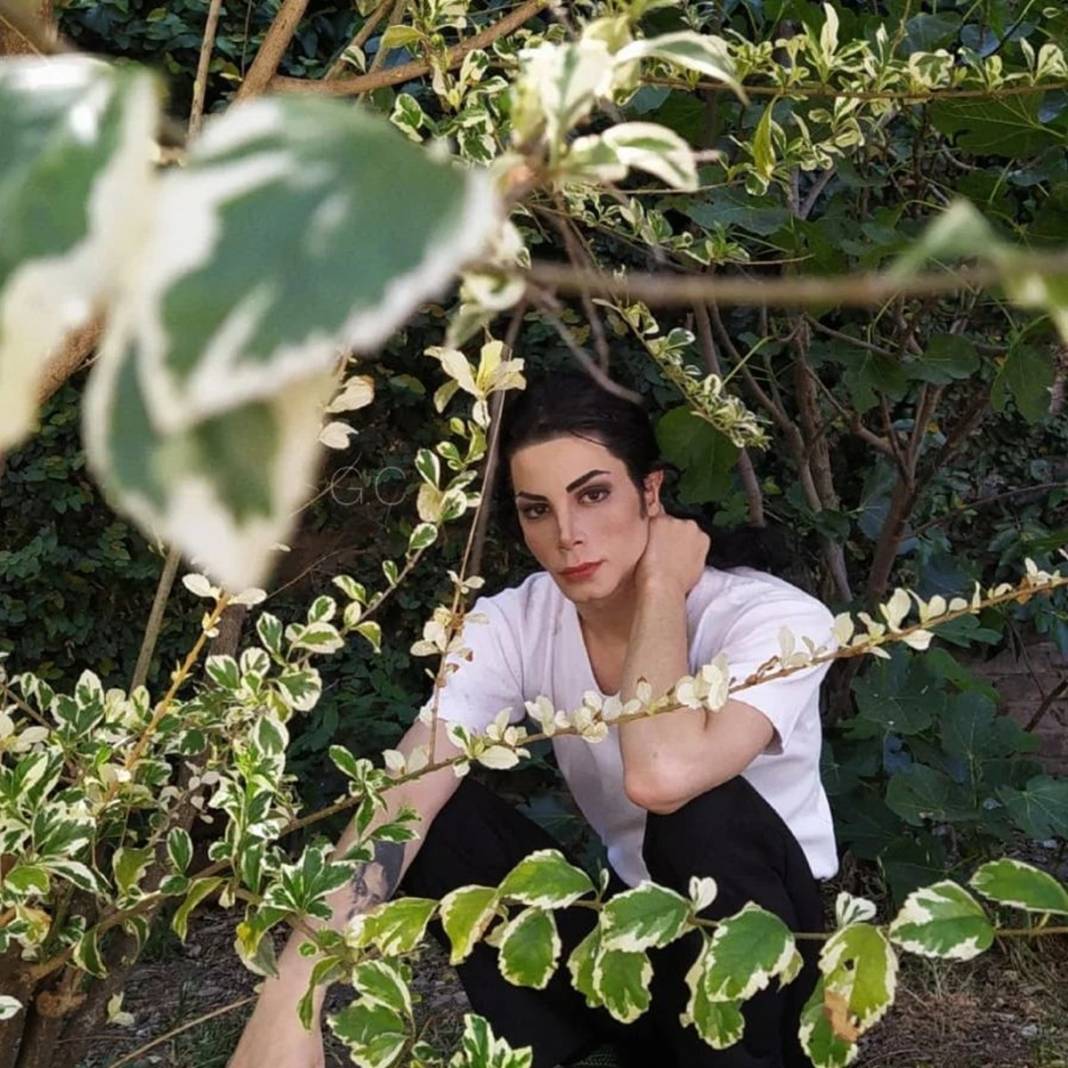 Michael Jackson'a benzemek için 40 bin dolar harcadı! Bakın neye benzedi... 43